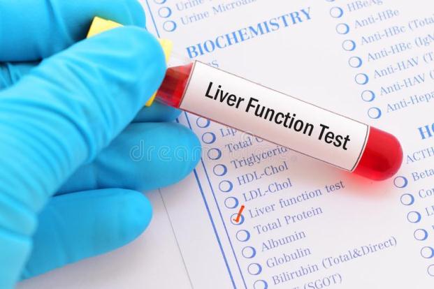 LIVER FUNCTION TEST Sunrise Diagnostic Laboratory