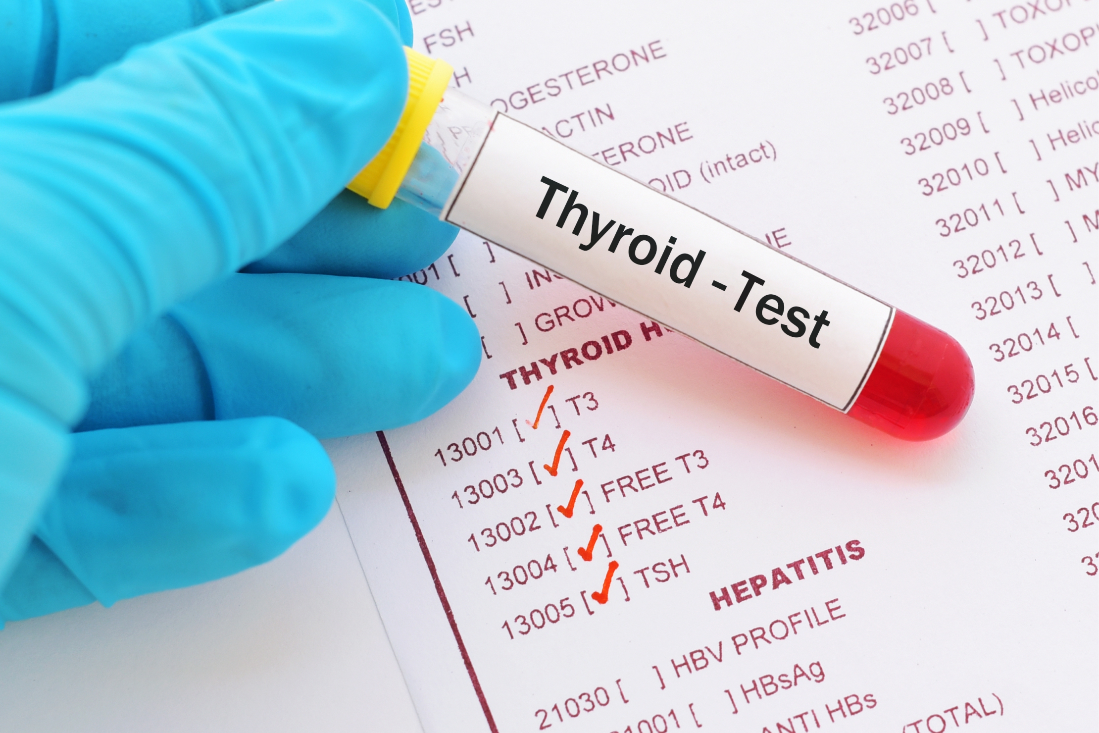 THYROID FUNCTION TESTS T3 T4 TSH Sunrise Diagnostic Laboratory